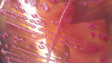 lab-smear